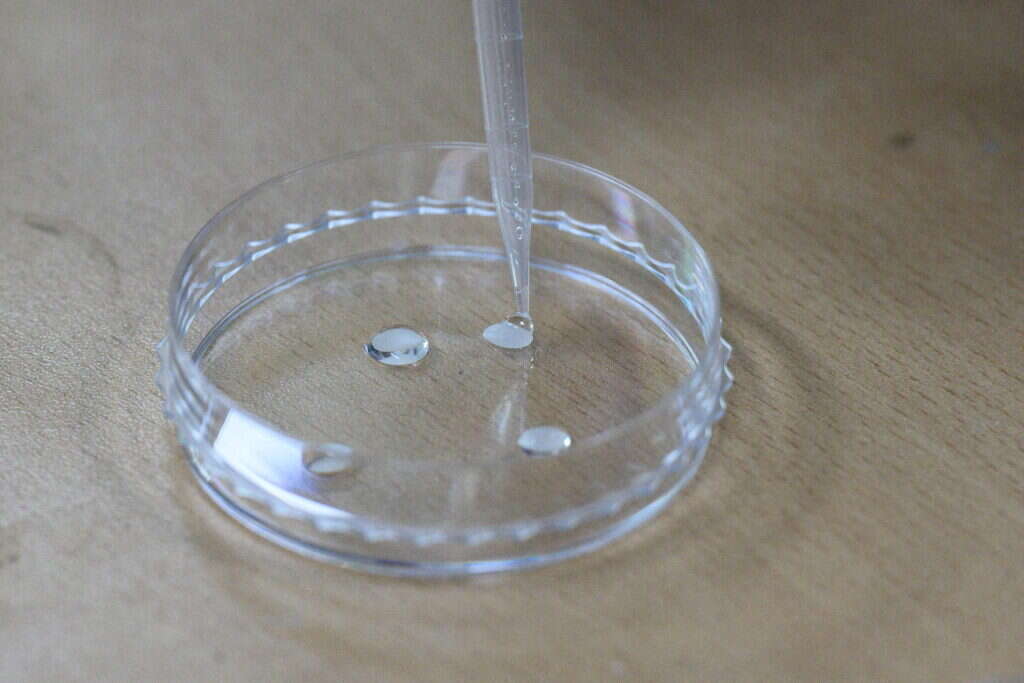 התרבית בצלחת הפטרי. | Anthony WALLACE / AFP