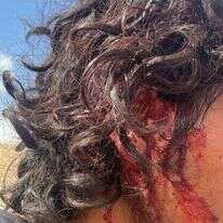 ניצול הלינץ' ליד מבואות יריחו בבקעת הירדן. ללא קרדיט