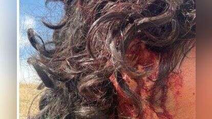 ניצול הלינץ' ליד מבואות יריחו בבקעת הירדן. ללא קרדיט