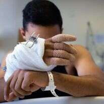 ידו הפצועה של תימור כהן־ששון, לפני כשנה. | אריק סולטן