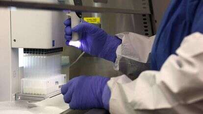 בדיקות מעבדה. | Getty Images via AF בדיקות מעבדה. | Getty Images via AF