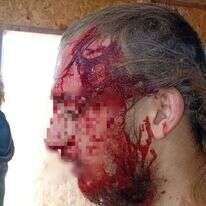 רועה צאן יהודי הותקף בגוש עציון. ללא קרדיט