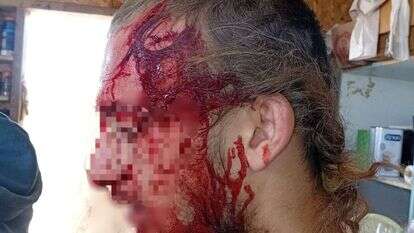 רועה צאן יהודי הותקף בגוש עציון. ללא קרדיט