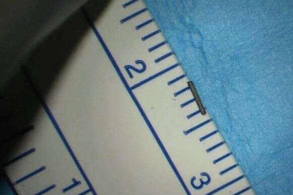 העיפרון שהוצא מהעין | דוברות שערי צדק העיפרון שהוצא מהעין | דוברות שערי צדק