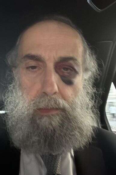 לאחר התקיפה השנייה | באדיבות המצולם לאחר התקיפה השנייה | באדיבות המצולם