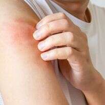 גירוד ובעיות עור | שאטרסטוק