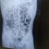 צילום גוף, בו נראות המספריים | שערי צדק