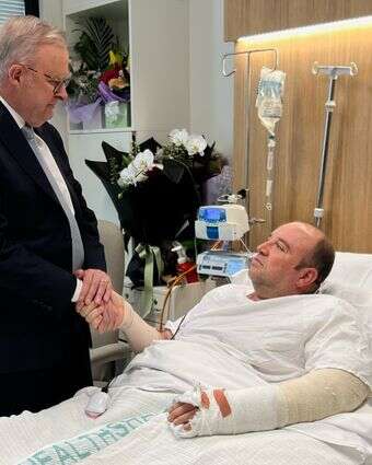 ראש ממשלה אוסטרליה, אנתוני אלבנז מבקר את אחמד אל-אחמד בבית החולים סנט ג'ורג' בסידני לאחר הפיגוע | AP