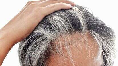 שיער שהולך ומלבין לו | שאטרסטוק