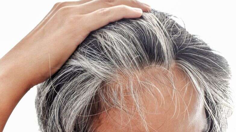 שיער שהולך ומלבין לו | שאטרסטוק