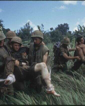 האבחנה הפוסט־טראומטית הגיעה לעולם בעקבות מלחמת וייטנאם מתוך הסדרה "מלחמת וייטנאם" | באדיבות יס