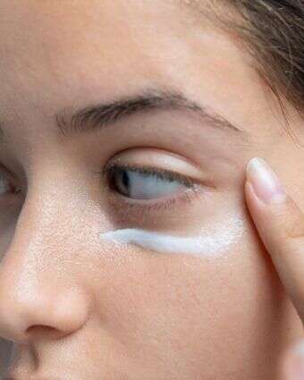 שקיות מתחת לעיניים? יש פתרון | שאטרסטוק