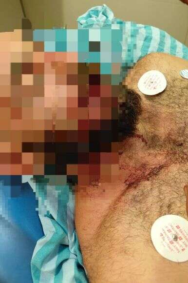 המתיישב שנפצע בהרס חוות תל תלפיות | פרטי המתיישב שנפצע בהרס חוות תל תלפיות | פרטי