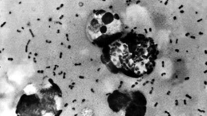 חיידקי Yersinia pestis, הגורמים למחלת הדבר, 1965 | shutterstock חיידקי Yersinia pestis, הגורמים למחלת הדבר, 1965 | shutterstock