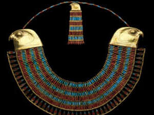 הצמיד של נפרופטה הצמיד של נפרופטה