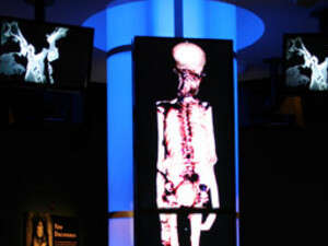 סריקת ה-CT של תות ענך אמון סריקת ה-CT של תות ענך אמון