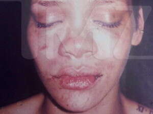 ריהאנה החבולה. צילום ארכיון: ריהאנה החבולה. צילום ארכיון: