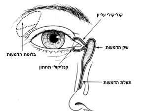 חסימת דרכי הדמעות. חסימת דרכי הדמעות.