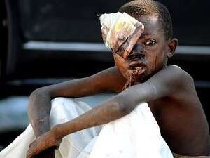 ילד פצוע אחרי רעידת האדמה בהאיטי. ילד פצוע אחרי רעידת האדמה בהאיטי.