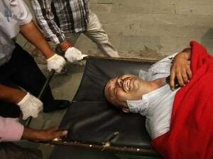 אדם שנפצע בפיצוץ בניו דלהי. הדאגה בהודו גוברת אדם שנפצע בפיצוץ בניו דלהי. הדאגה בהודו גוברת