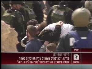 פינוי פצוע בעמונה. צילום: ערוץ 2 פינוי פצוע בעמונה. צילום: ערוץ 2