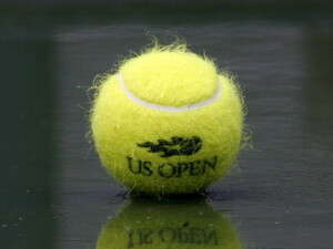 בניסוי נתבקשה האשה שבתרדמת לדמיין שהיא משחקת טניס או צועדת סביב ביתה בניסוי נתבקשה האשה שבתרדמת לדמיין שהיא משחקת טניס או צועדת סביב ביתה