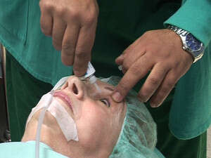 ניתוח עיניים (למצולמים אין קשר לידיעה) ניתוח עיניים (למצולמים אין קשר לידיעה)