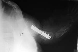 צילום רנטגן לאחר הניתוח. צילום: ד''ר צחי אייזנברג, מרפאת כל חי צילום רנטגן לאחר הניתוח. צילום: ד''ר צחי אייזנברג, מרפאת כל חי