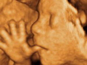 ���� ������� �����