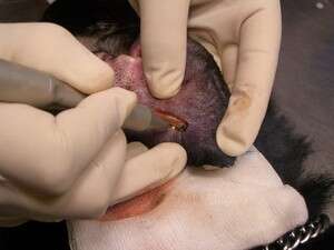 ד''ר סמדר טל מנתחת. ניתוח אוראל המטומה ד''ר סמדר טל מנתחת. ניתוח אוראל המטומה