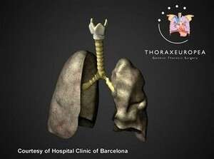 ��� ������ ������ ���� ������ ��������. ����� - ����� �� ����� ���� ������