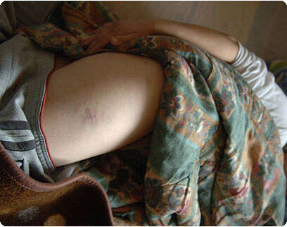 מקס ילינסון מקס ילינסון