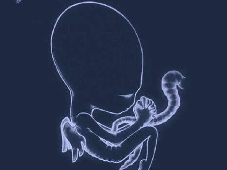 עטיפת האלבום עטיפת האלבום