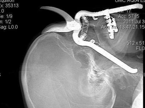 צילום: איי-פי צילום: איי-פי