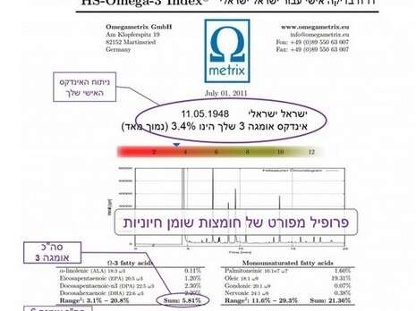 יח''צ יח''צ
