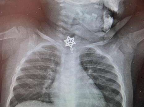 צילום: בית חולים קפלן צילום: בית חולים קפלן