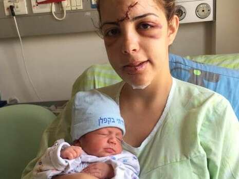 צילום: אופיר לוי – דובר ביה''ח קפלן צילום: אופיר לוי – דובר ביה''ח קפלן