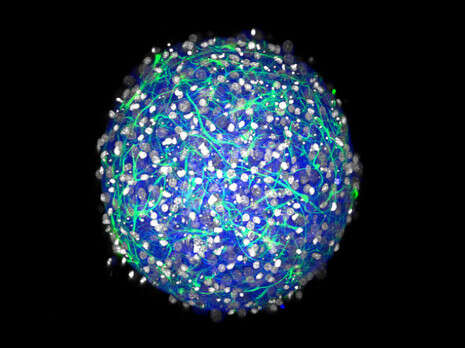 צילום: Hoffman-Kim lab, Brown Univers צילום: Hoffman-Kim lab, Brown Univers