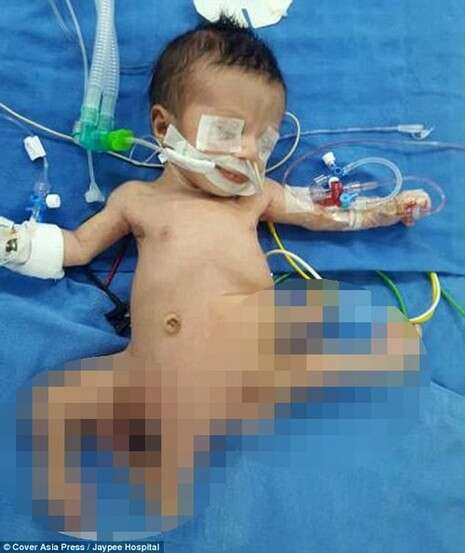 צילום: jaypee hospital צילום: jaypee hospital