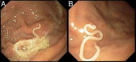 צילום: BMJ CASE REPORTS צילום: BMJ CASE REPORTS
