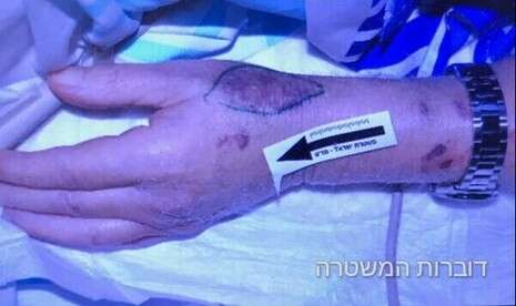 צילום: דוברות המשטרה צילום: דוברות המשטרה