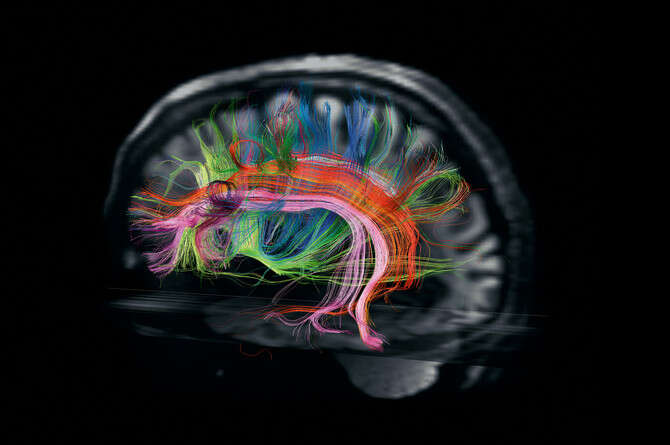 : VAN WEDEEN AND L. L. WALD, MARTINOS CENTER FOR BIOMEDICAL IMAGING, HUMAN CONNECTOME PROJECT