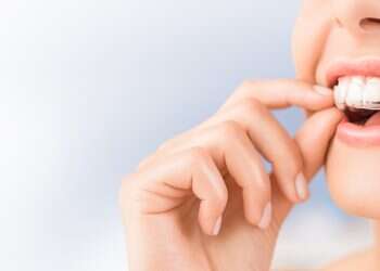 ליישר את השיניים בלי שאף אחד ידע