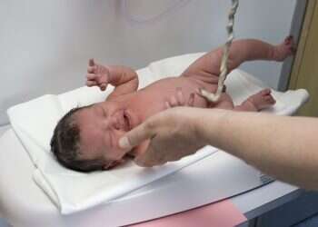 ד”ר הלל וקסלר:  על הסיבוכים של ליפוף חבל הטבור סביב העובר