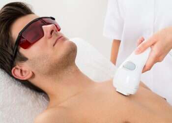 הסרת שיער בלייזר: כל מה שרצית לדעת