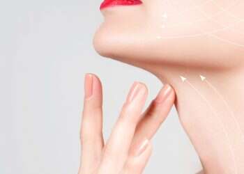 סופרנו: הסרת שיער בלייזר