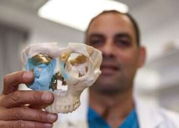 צילום: אנצ'ו גוש - ג'יני