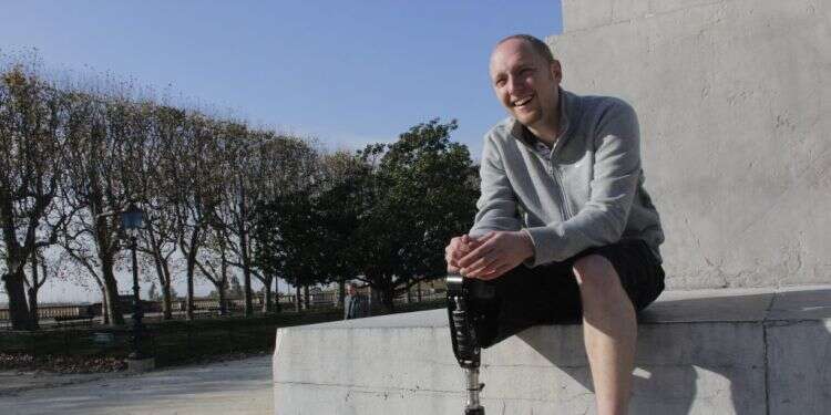 צילום: Blatchford צילום: Blatchford