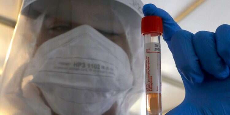 איך תדעו שהחלמתם מקורונה?