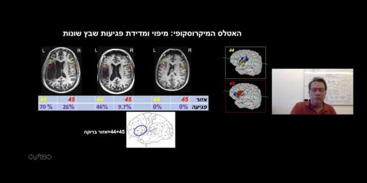 פרופ' גרודז'ינסקי. צילום מסך לא צריך ללמוד רפואה כדי לשמוע הרצאה במדעי המוח